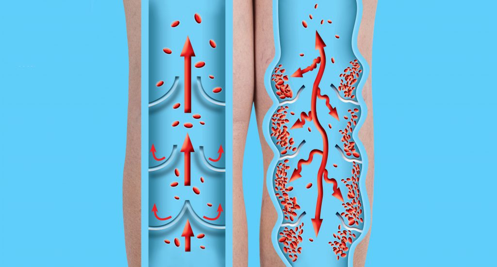 Natto: The Japanese secret to healthy circulation